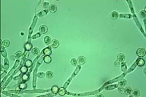 Nấm candida, tác nhân nhiễm khuẩn âm đạo dưới kính hiển vi